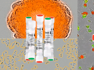 Sartorius acquires Essen BioScience
