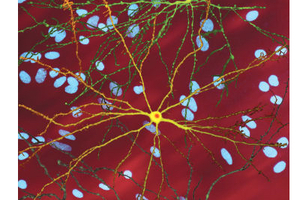 Scientists to develop life-transforming drugs for Huntington’s disease sufferers 