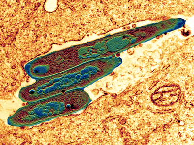 Serum Institute of India acquires rights to TB vaccine