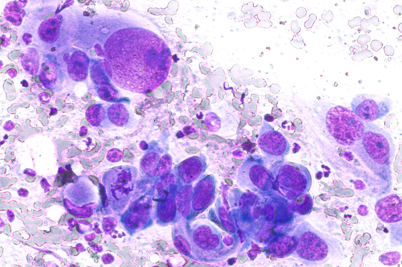 Servier to develop and commercialise targeted solid tumour therapy, BDTX-4933