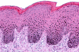 SGS supports non-animal clinical testing with release of 3D skin model white paper