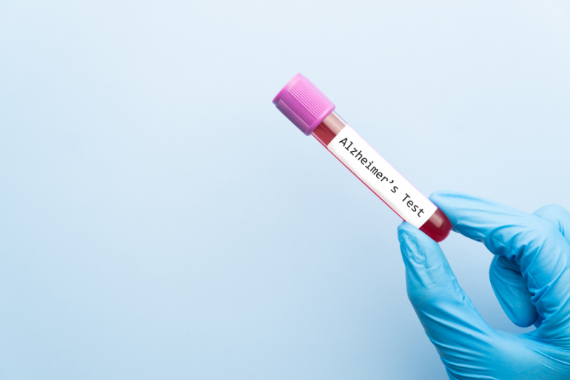 Siemens Healthineers launches blood-based pTau217 and BDTau research assays for Alzheimer's and neurological disease