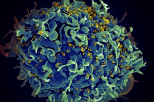 Societal CDMO wins tech transfer and production contract for HIV drug candidate