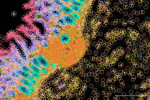 Spatial biology multi-omics profiling tools