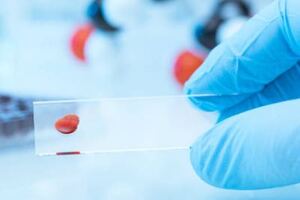Sphere Fluidics closes $2 million investment round