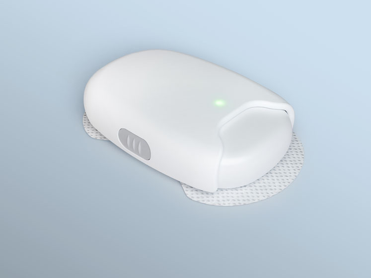 Stevanato and Bexson Biomedical to develop a customised wearable ketamine delivery device