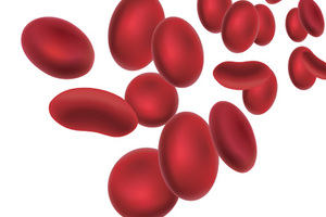 Strategies to eliminate upstream variability in bioprocessing