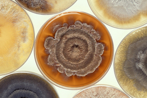 Synbiosis introduces Chromogenic ID media software
