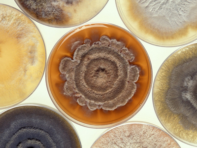 Synbiosis introduces Chromogenic ID media software
