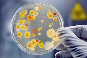 Taking a multifaceted approach to combatting superbugs
