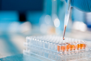 Tecan and UgenTec partner to offer sample-to-result solutions for qPCR
