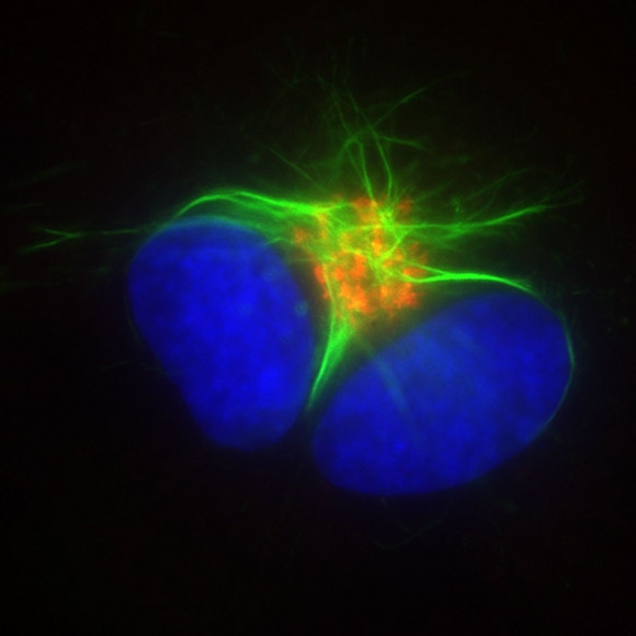 The Olympus cell^R and cell^M for high-end imaging