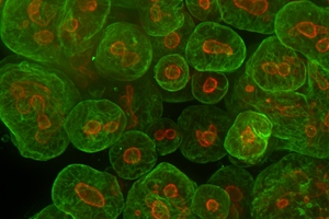 Thermo Fisher introduces tumoroid culture medium to accelerate cancer therapies