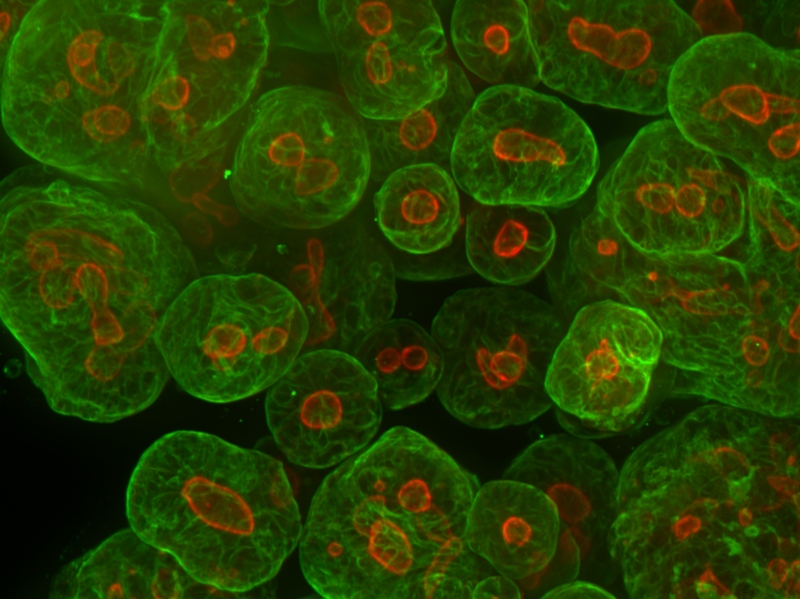 Thermo Fisher introduces tumoroid culture medium to accelerate cancer therapies