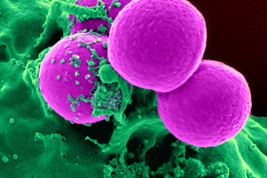 TrakCel and Lonza complete gene therapy manufacturing and orchestration solutions integration milestone