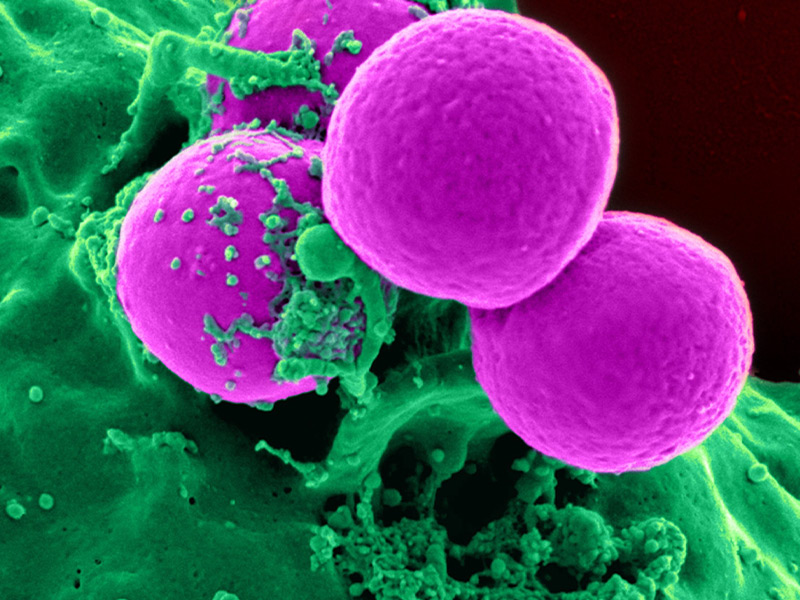 TrakCel and Lonza complete gene therapy manufacturing and orchestration solutions integration milestone