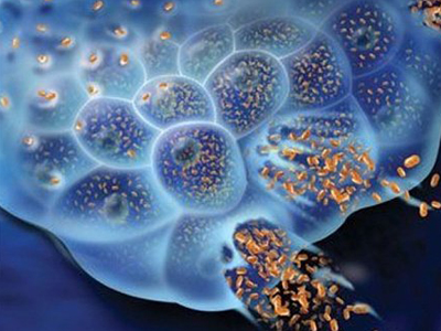 Transgene and Randox to develop innovative multifunctional oncolytic virotherapies for solid tumors