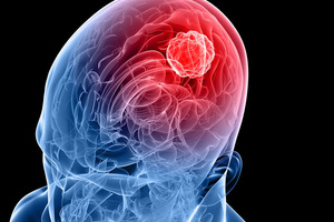 Transgene, NEC and BostonGene expand neoantigen cancer vaccine collaboration