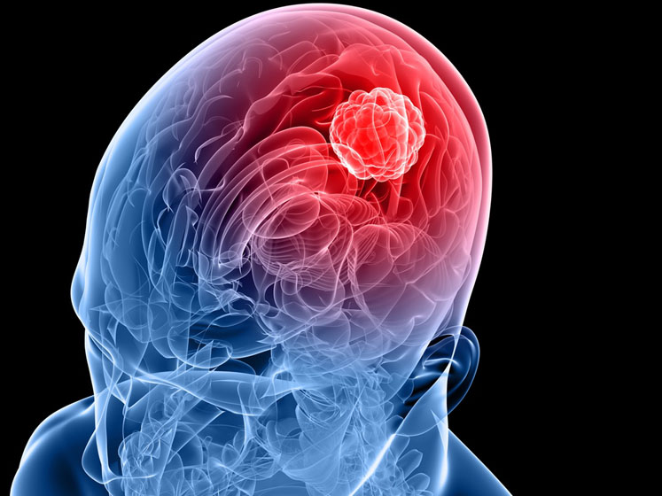 Transgene, NEC and BostonGene expand neoantigen cancer vaccine collaboration