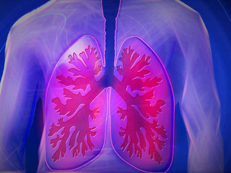 Transpire Bio announces agreement with Recipharm for the development of an inhaled medicine
