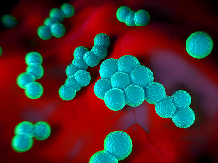 Treating infection with precise medicine may prevent our next pandemic

