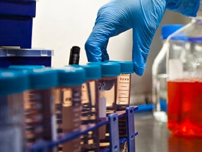 TxCell completes CAR-Treg manufacturing process development
