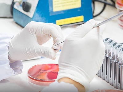 UK and Russian researchers join forces against AMR