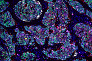 Unlocking the secrets of cells: the revolutionary power of spatial biology