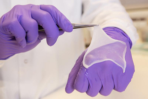 Wound care product supports healing without skin graft