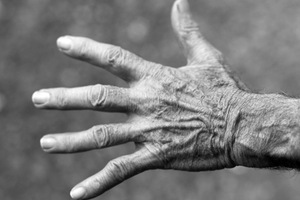 Xadago to be commercialised for Parkinsons in Canada